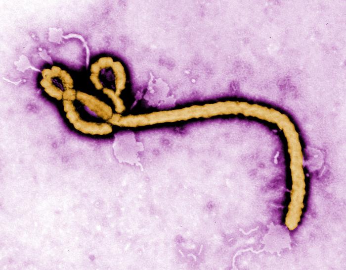 Ebola Virus Translocation Model May Clarify Human Skin Transmission