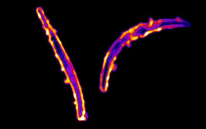 New Antibodies Bind to Previously Untargeted Regions of Malaria